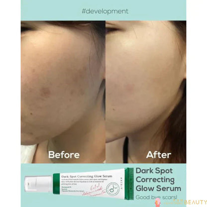 Axis-Y Dark Spot Correction Glow Serum